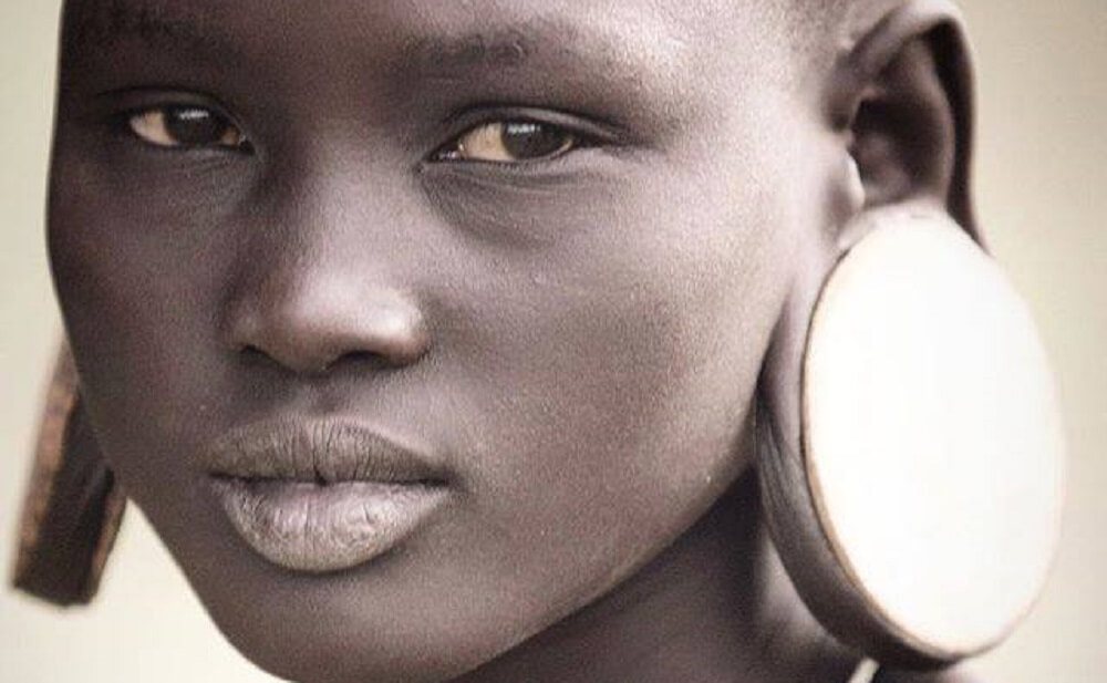 Um destino pior do que a morte para dezenas de mulheres africanas
