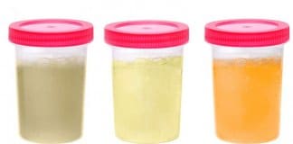 7 coisas que seu xixi está tentando informá-lo sobre sua saúde