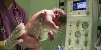 Os bebês nascidos por cesariana são mais propensos a ser obesos?