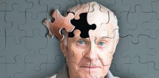 Cinco sinais de alerta da doença de Alzheimer