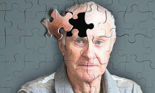 Cinco sinais de alerta da doença de Alzheimer