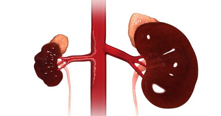 pensarcontemporaneo.com - Covid-19 tem possível associação com inflamação renal, apontam estudos