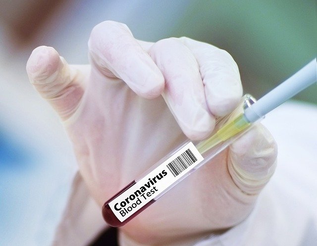 Vacina contra Covid-19: países ricos reservam doses e deixam países pobres sem