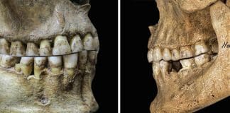 A antiga mudança para comida macia nos deu uma sobremordida – e a capacidade de pronunciar ‘f’s e’ v’s