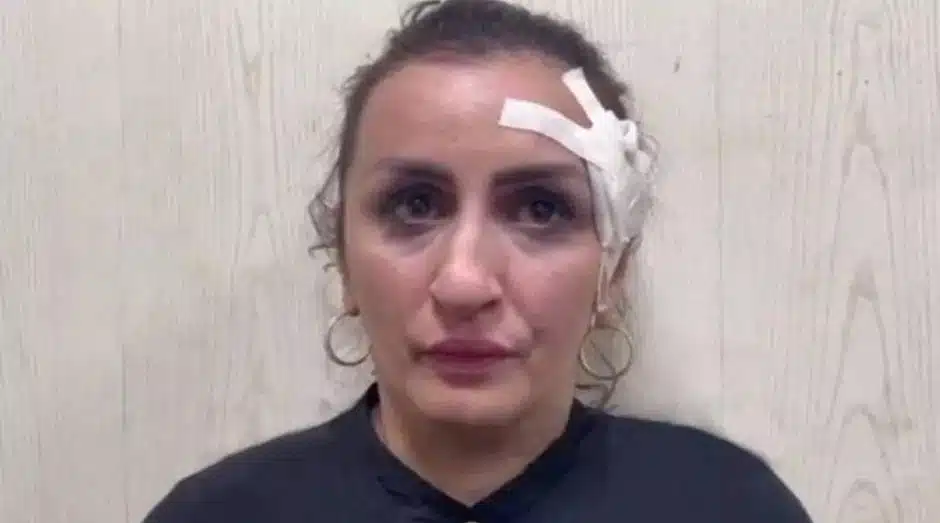 csm_Collage_Maker-13-Jul-2022-12.45-PM_902e875d1b Mãe vendeu o próprio filho para pagar uma cirurgia plástica no nariz