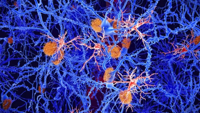 pensarcontemporaneo.com - Dia Mundial do Alzheimer: 4 coisas que aprendemos nos últimos 4 anos sobre a doença