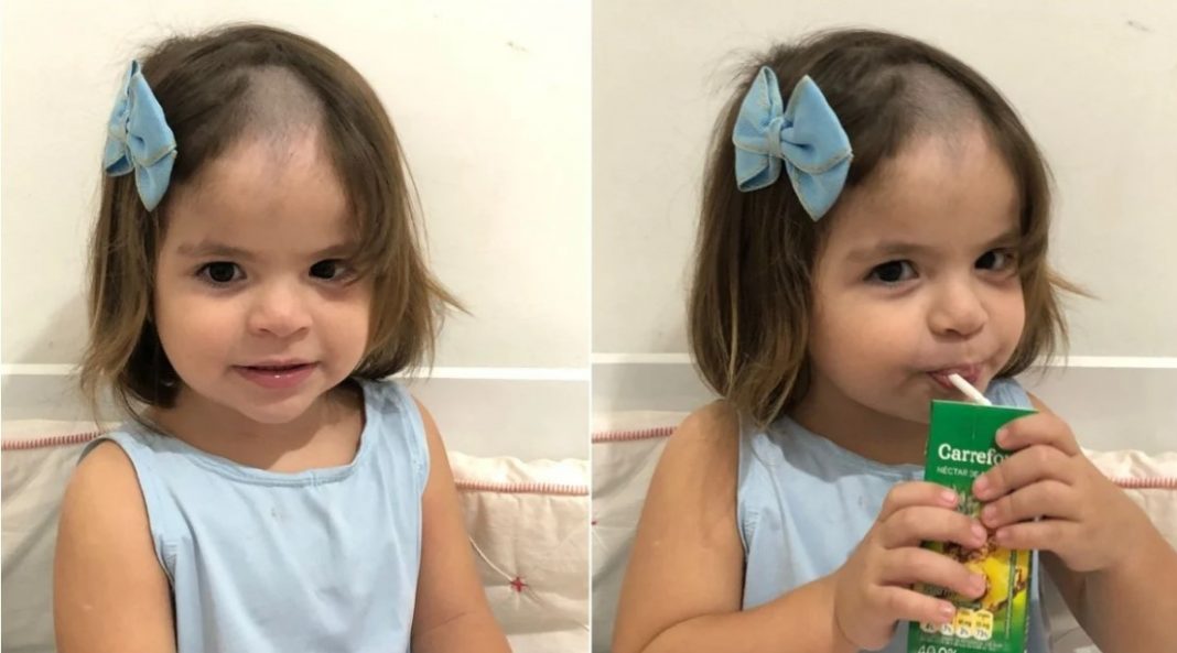 ‘Calva de cria’: Menina de 2 anos raspa cabelo escondida dos pais e vídeo viraliza
