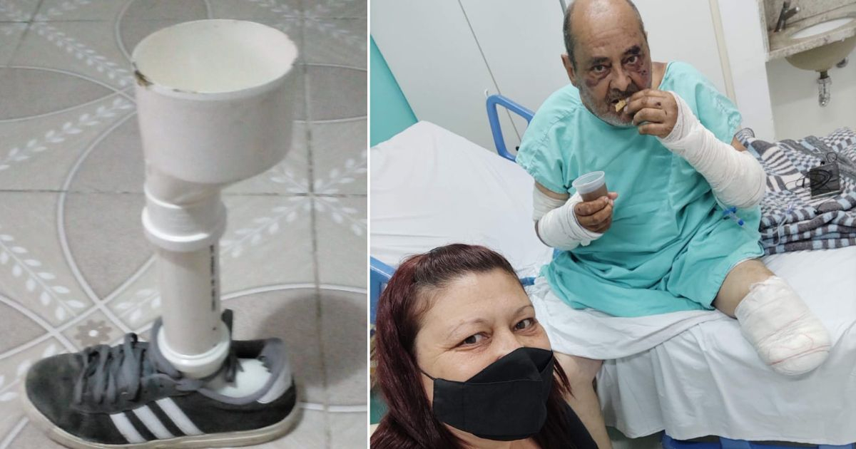 pensarcontemporaneo.com - Sem condições financeiras, idoso de 64 anos constrói a própria prótese com cano de PVC