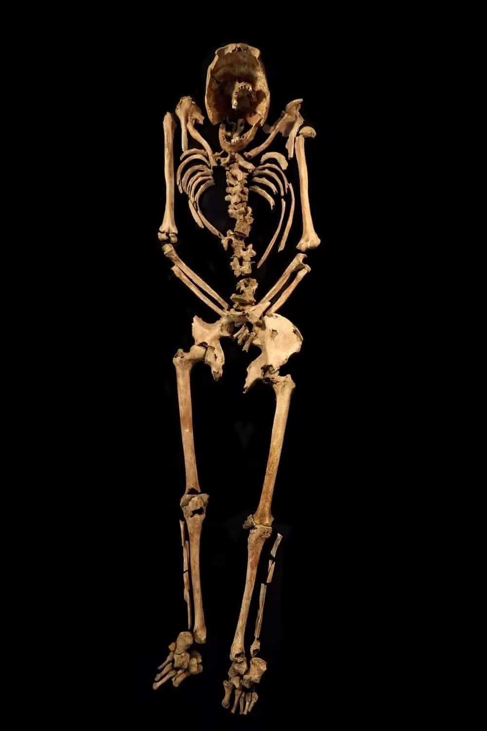pensarcontemporaneo.com - Artista forense recria rosto de escravizado crucificado pelo Império Romano há 2 mil anos; veja resultado