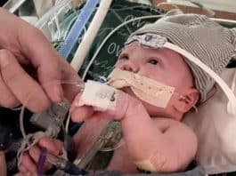 Bebê que recebeu 1º transplante de coração do tipo no mundo segue bem um ano após cirurgia