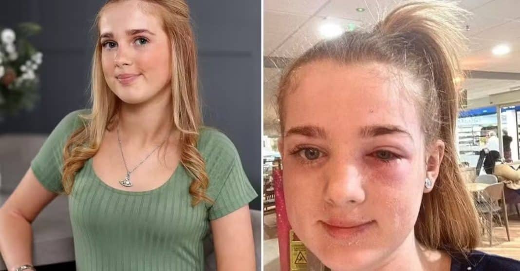 Menina de 13 anos quase fica cega após levar ‘dica de beleza’ no TikTok à sério demais