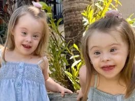 "Senti amor e felicidade ao tê-las nos meus braços", diz mãe que descobriu só no parto que suas gêmeas tinham Down