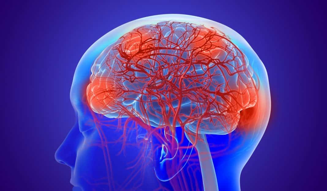 “Você acha que demência começa com esquecimento? Médico alerta: o sintoma é outro — e assustador