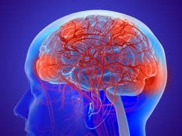 “Você acha que demência começa com esquecimento? Médico alerta: o sintoma é outro — e assustador