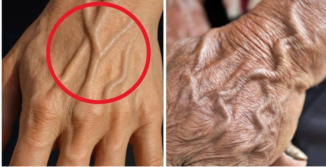 Veias muito visíveis - Entenda o que o teu corpo pode estar tentando lhe dizer Veias muito visíveis? Entenda o que o teu corpo pode estar tentando lhe dizer