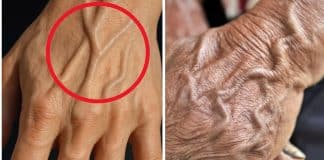 Veias muito visíveis? Entenda o que o teu corpo pode estar tentando lhe dizer Veias muito visíveis - Entenda o que o teu corpo pode estar tentando lhe dizer