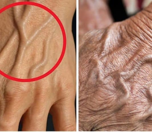 Veias muito visíveis - Entenda o que o teu corpo pode estar tentando lhe dizer