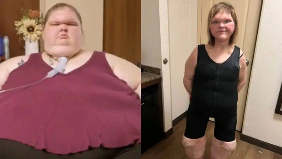 Elas sumiram após “Quilos Mortais”, mas o antes e depois voltou a chocar o público