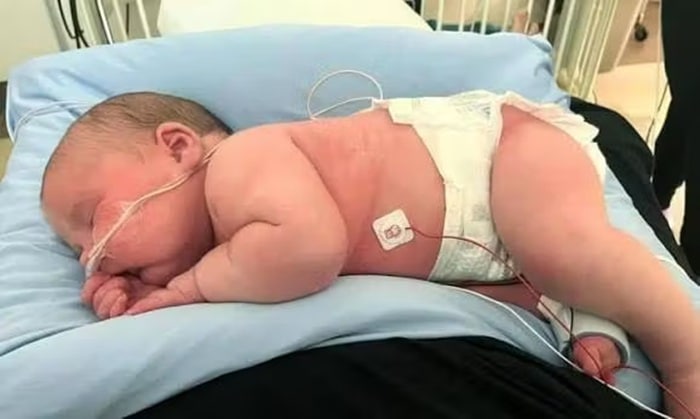 pensarcontemporaneo.com - Nasce no Brasil beb&ecirc; de 7,3 quilos e 59 cm, mais que o dobro do peso de um rec&eacute;m-nascido - veja fotos