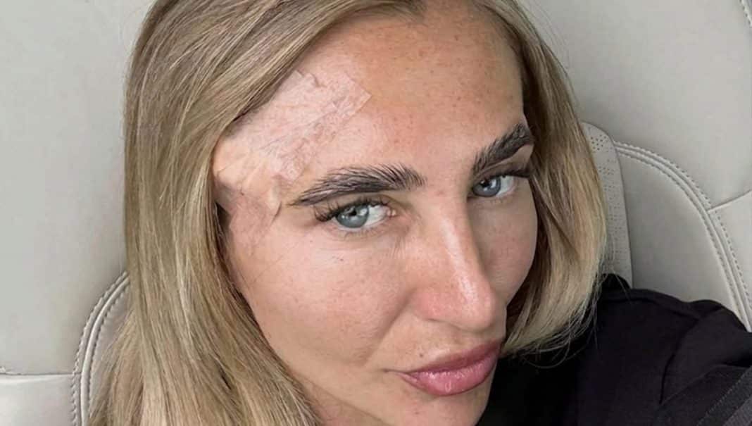 Ela buscava o bronzeado perfeito, mas aos 28 anos recebeu um diagnóstico assustador